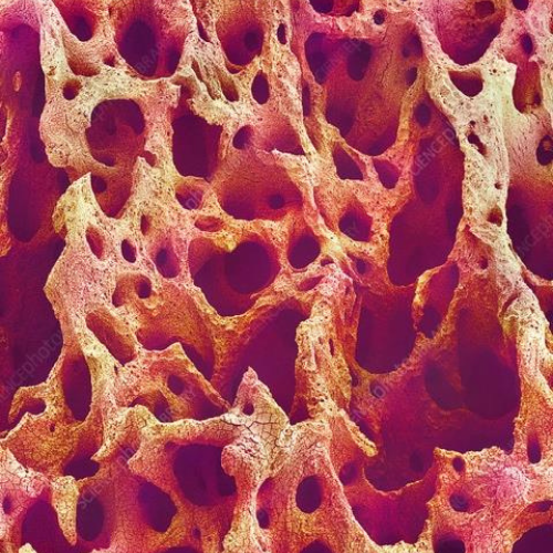 Orange and red microscopic view of bone tissue