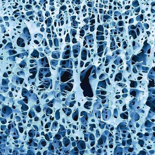 Blue and black microscopic view of bone tissue