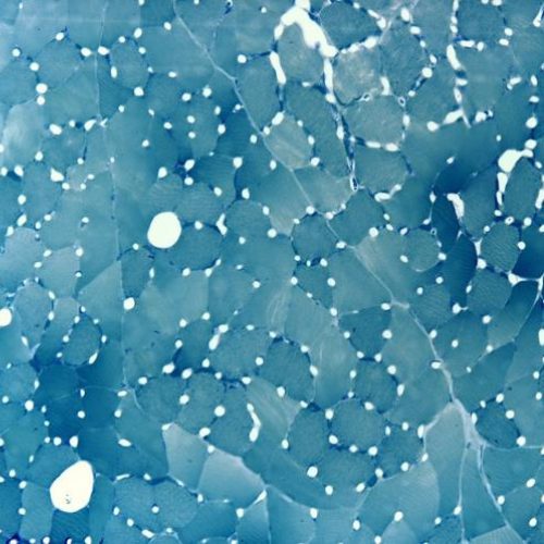 Blue microscopic view of skeletal muscle vascularization